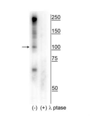 Western Blot: CtIP [p Ser327] Antibody [NBP2-60769]